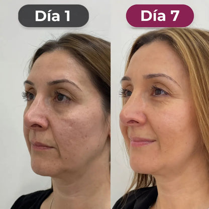 Secreto Coreano 3 en 1: Elimina Arrugas, Piel Firme y Luminosa - Desde el Día 1
